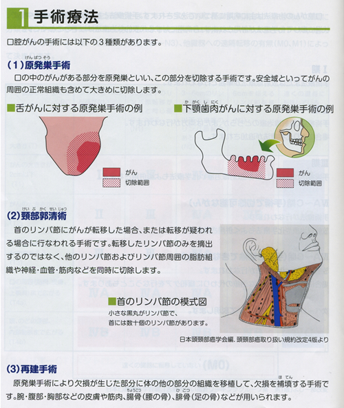 4 治療02