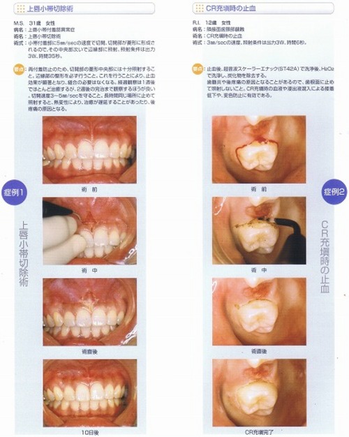 臨床例01